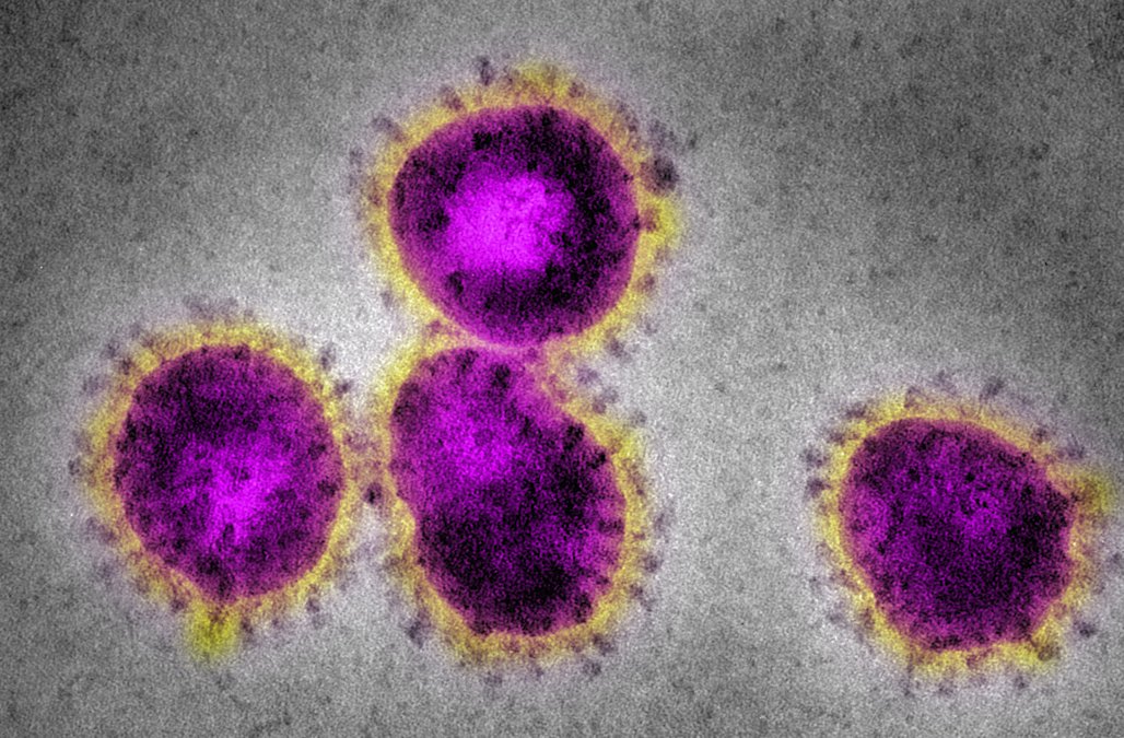  Nebraska Üniversitesi Corona Virüsü İlacı Üretti