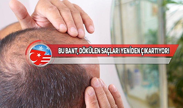 Bilim İnsanlarından Kellere, Saçı Dökülenlere Müjde!