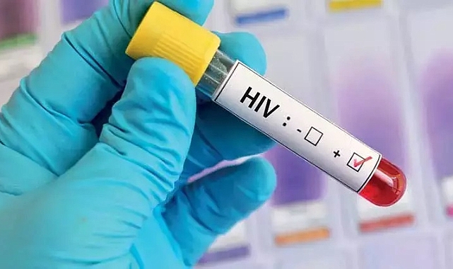 Hollanda'da HIV tedavisinde yeni umut: Hücreden ayırma denemesi başarılı