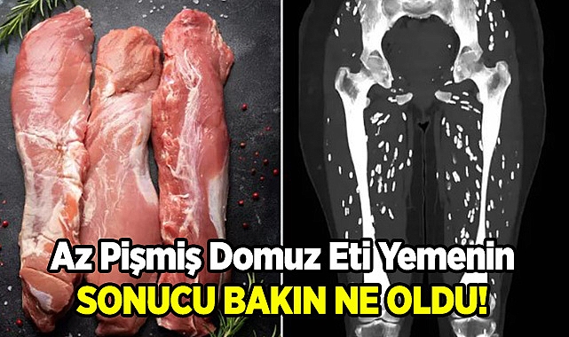 Az Pişmiş Domuz Eti Yedikten Sonra Bacakların Hali