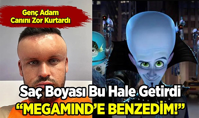 Saç Boyası Reaksiyonu Adamı 'Megamind'a Benzetti