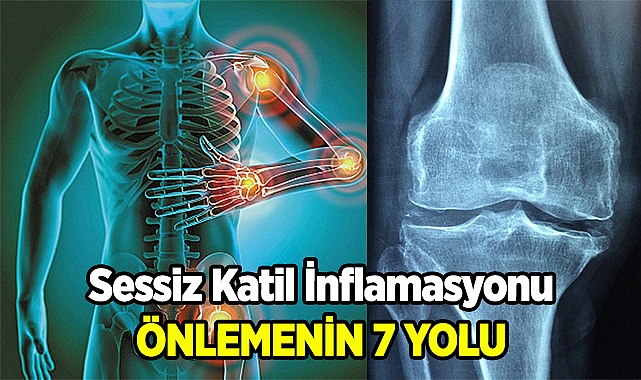 Sessiz Katil İnflamasyonu Önlemenin 7 Basit Yolu