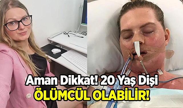 Gömülü Yirmi Yaş Dişi Öldürebilir! 