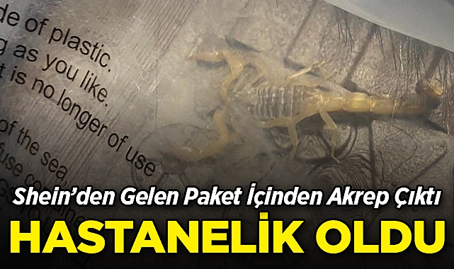 Shein'den Gelen Paket İçinden Akrep Çıktı: Hastanelik Oldu!